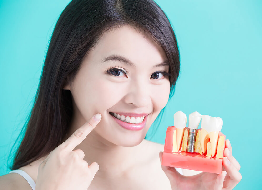 Dental Implants Web Story Image - 3